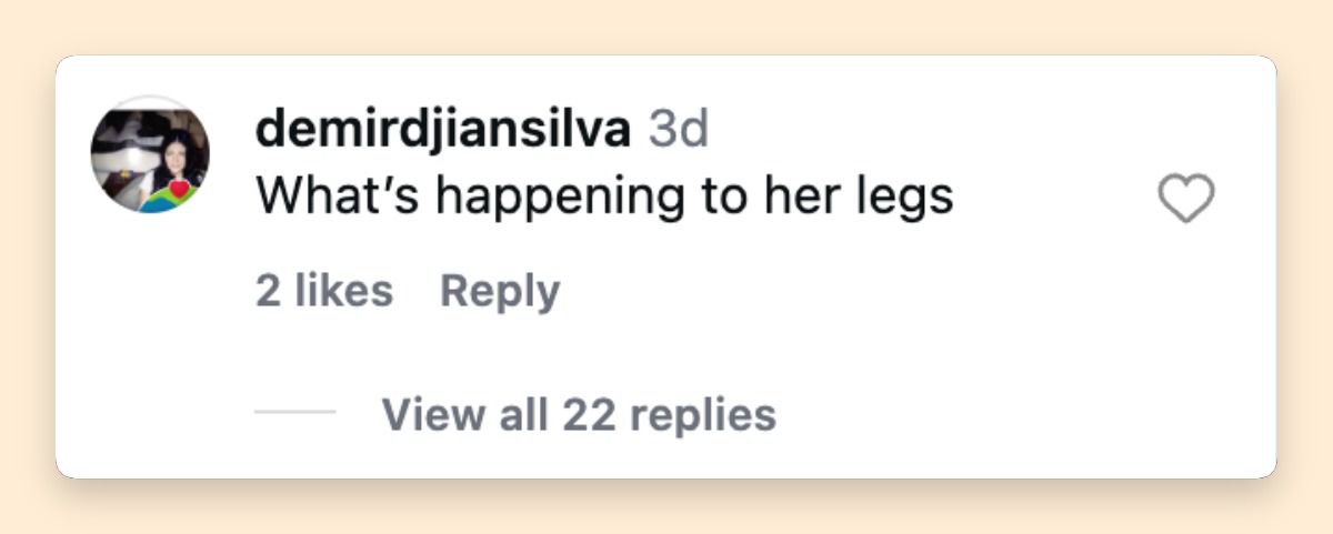 The focus on Griffith's legs quickly became one of the biggest talking points around the latest photos. One commenter asked directly, "What's happening to her legs," underscoring how intensely her appearance was being scrutinized. | Source: Instagram/backgrid_usa