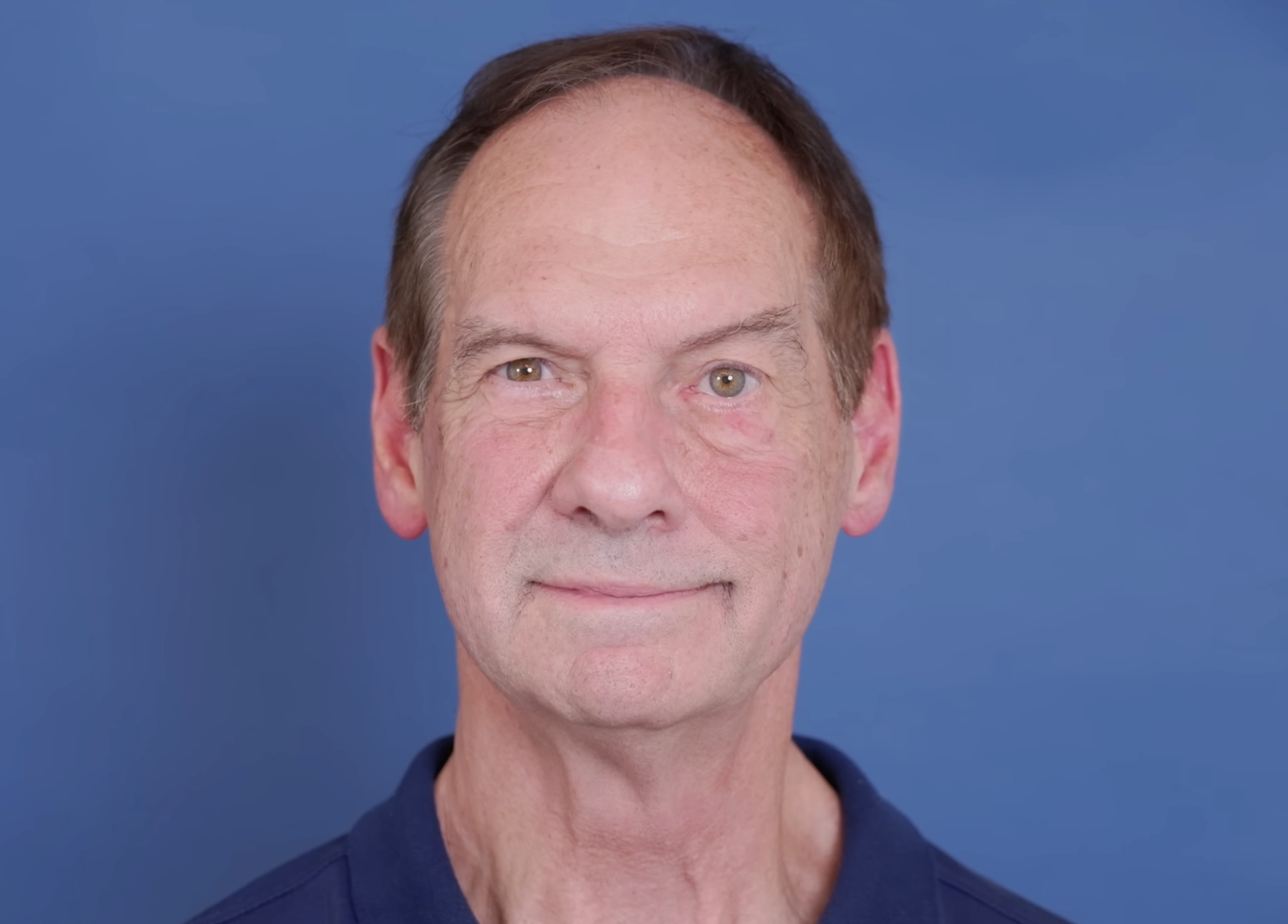 Barry Wolf before surgery, dated January 16, 2025 | Source: YouTube/@Dr.Truesdale
