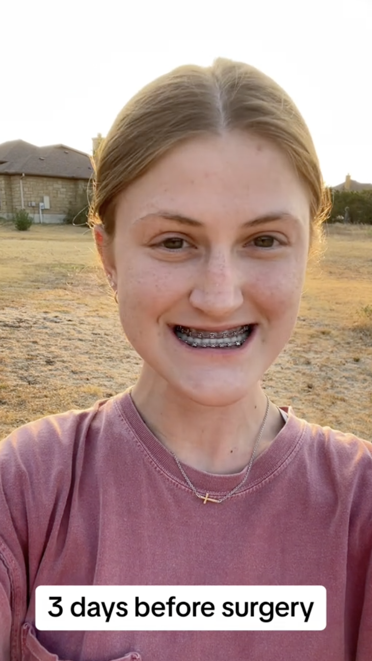 Looking straight ahead, Virginia Elder smiles confidently three days before surgery. | Source: TikTok/virginiaeelder