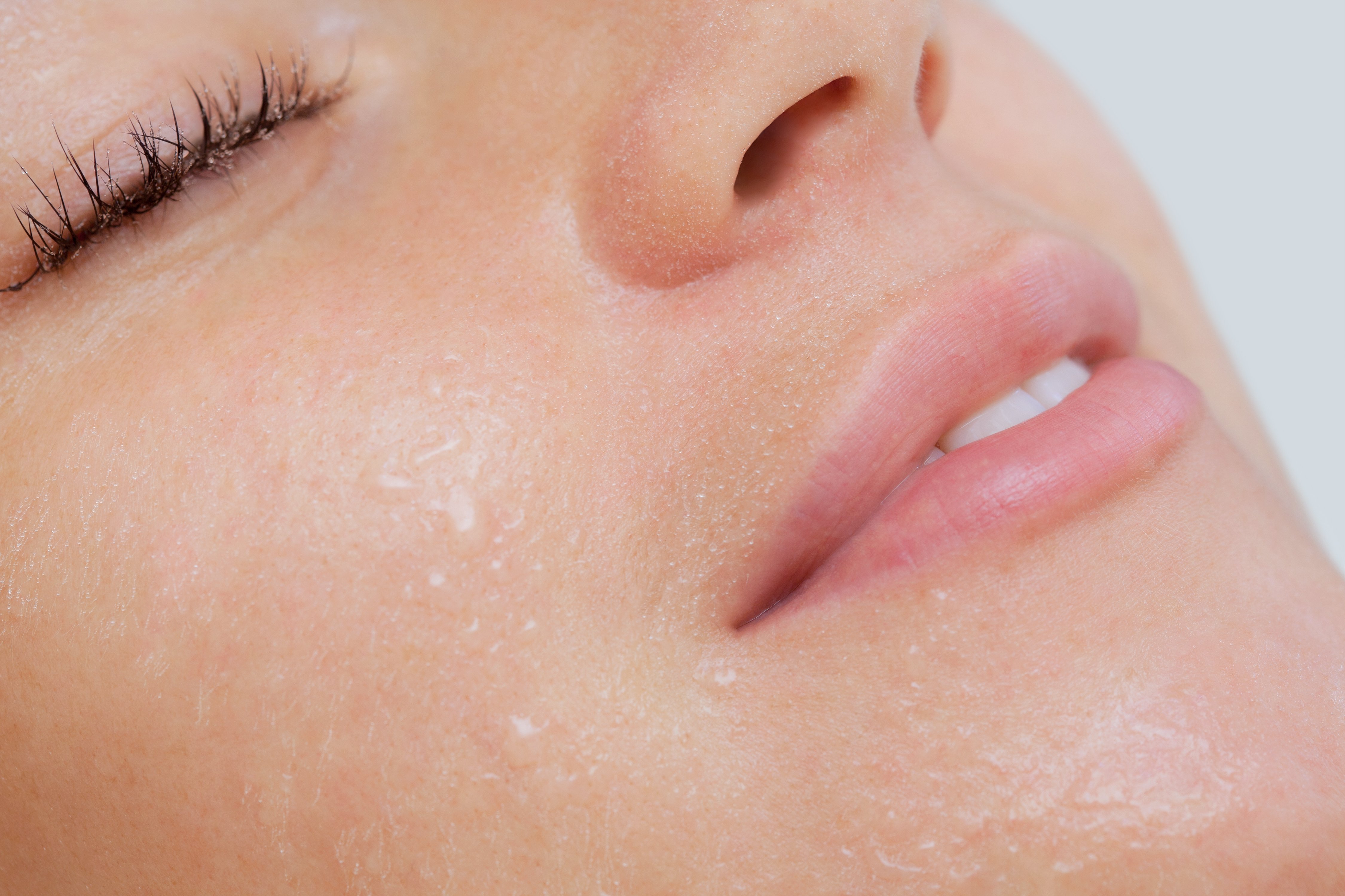 Skin after facial steaming | Source: Getty Images