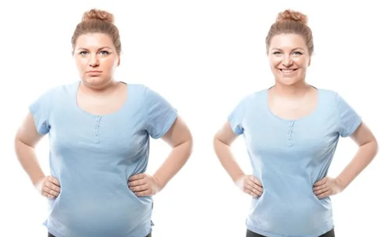 Une femme en surpoids | Photo : Shutterstock