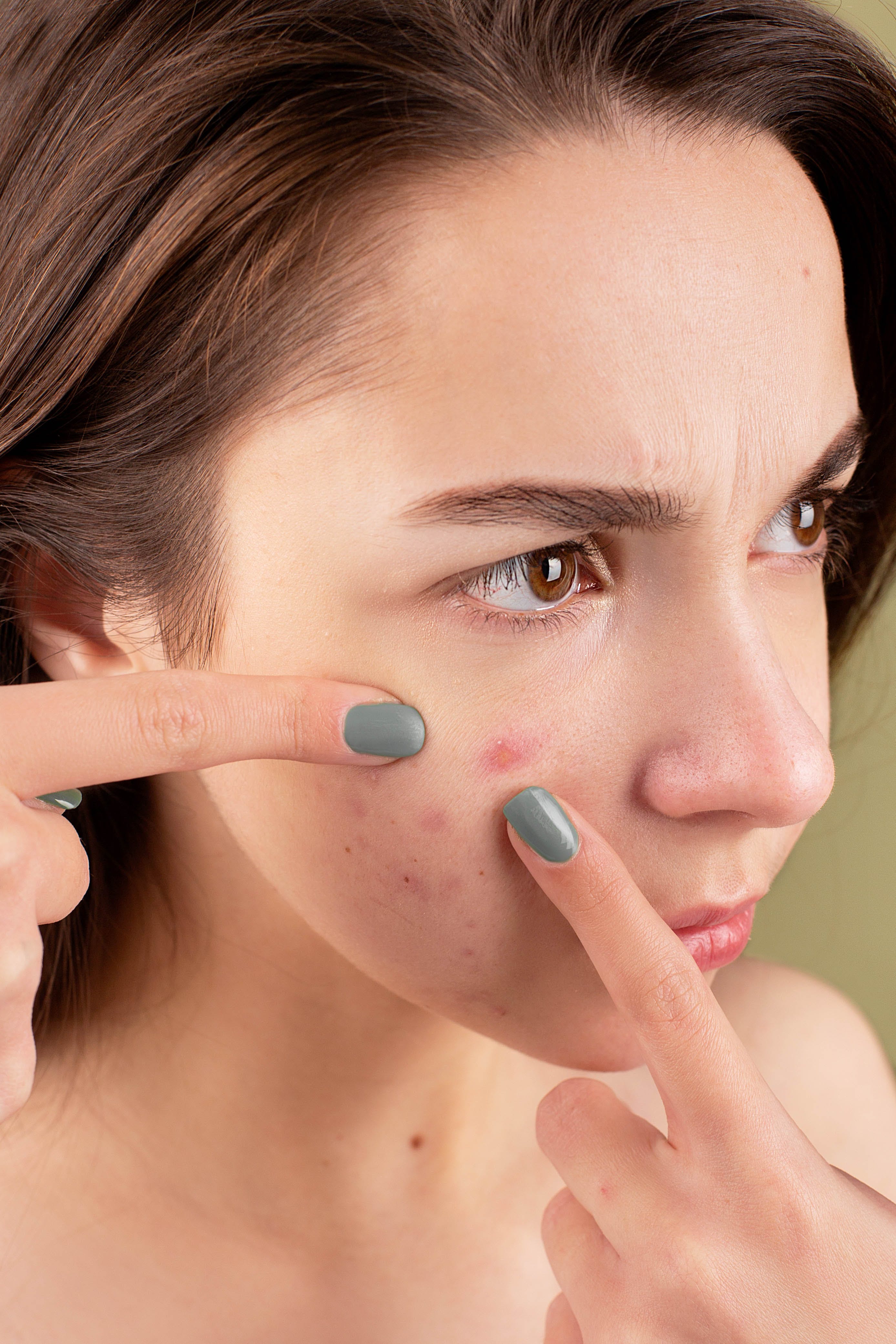 A lady squizing a pimple on her face: Source: Pexels