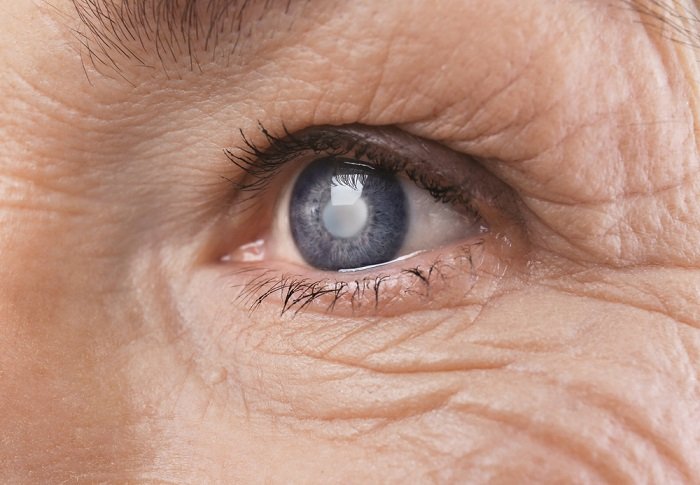 Mujer ciega| Foto: Shutterstock
