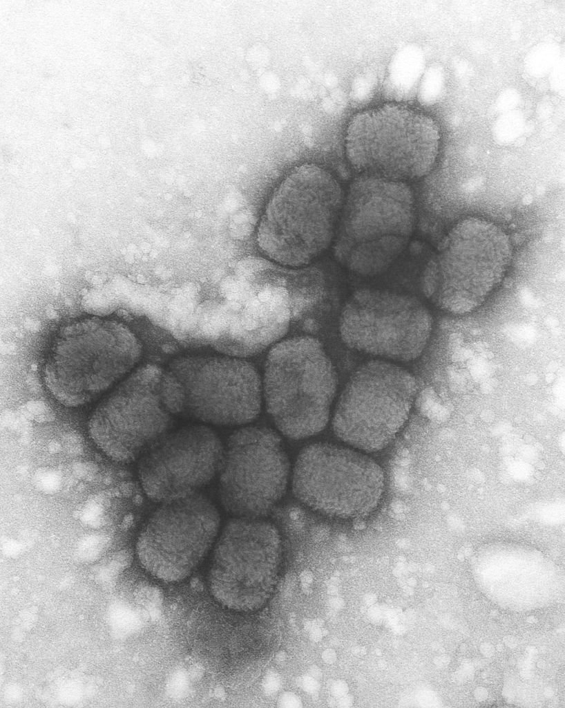 A transmission electron micrograph (TEM) of smallpox viruses using a negative stain technique, 1975 | Source: Getty Images