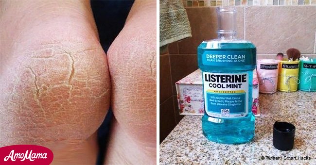 7 awesome uses for Listerine that can benefit the life of every woman
