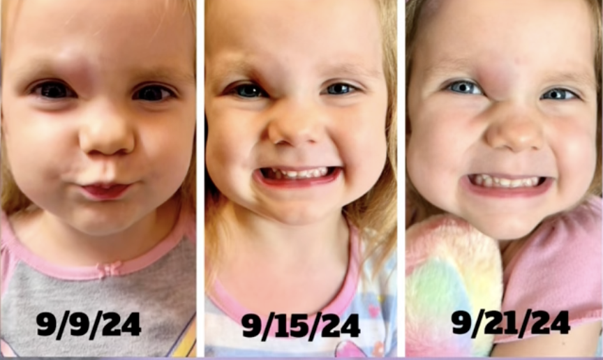 Pictures of Camryn at different stages of treatment, dated April 6, 2025 | Source: Tiktok/@mjaldridge