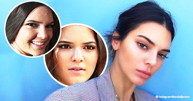 Kendall Jenner shares photo from her teenage years, revealing why she ‘ran home crying everyday’