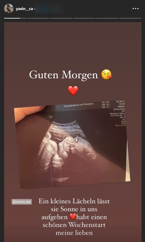 Yasin teilt ein Ultraschallbild seines bald geborenen Sohnes I Quelle: https: instagram.com/yasin__ca