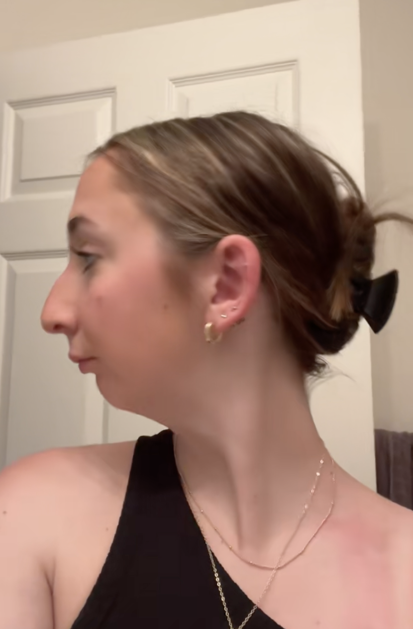 Maddie before undergoing double jaw surgery from a post dated August 2, 2023. | Source: TikTok/maddieakamofo