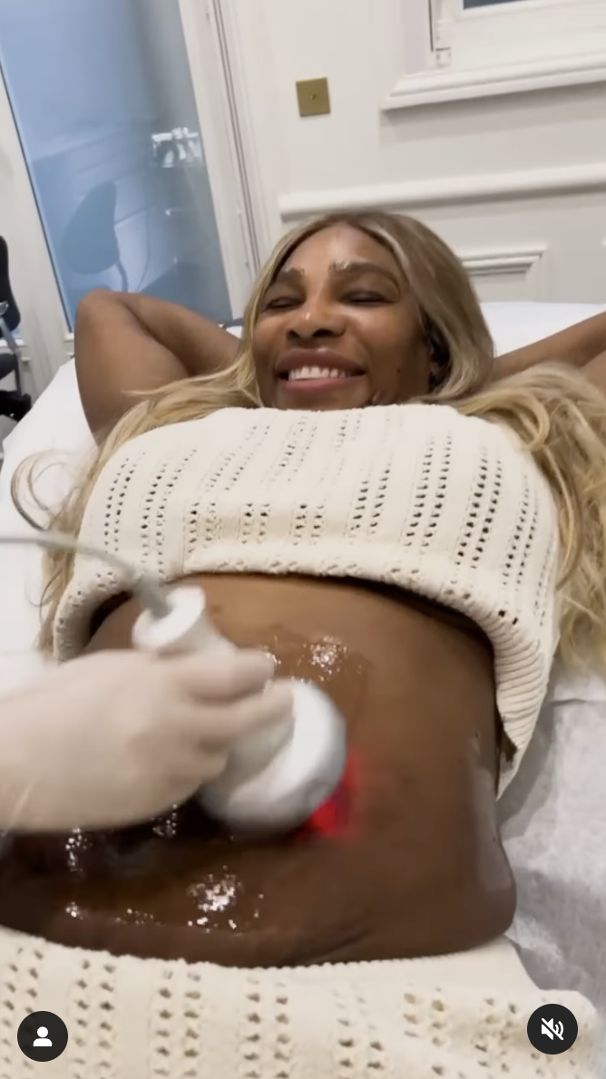 Serena Williams undergoing a tummy tightening procedure, as seen in a video dated June 15, 2024 | Source: Instagram/serenawilliams