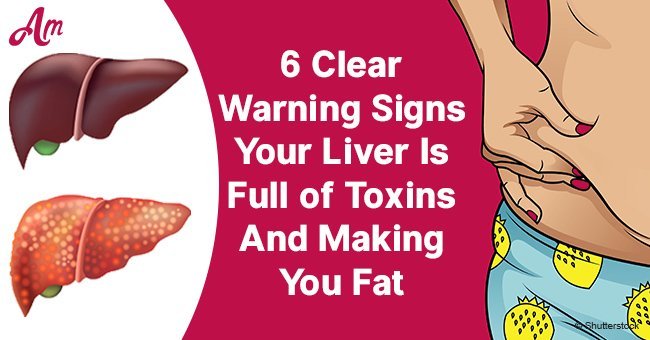 Note! Warning signs your liver is full of toxins