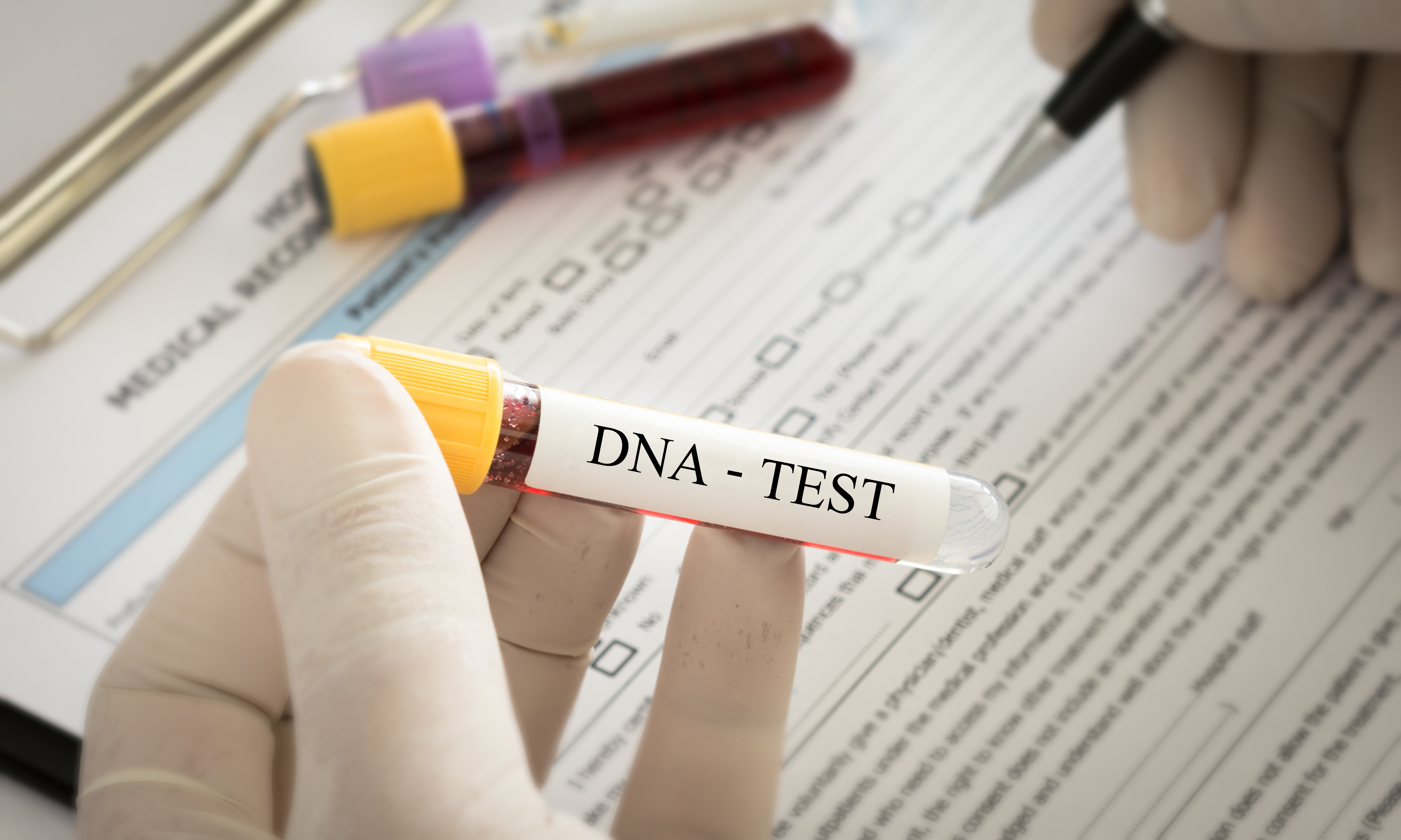 A DNA test | Source: Getty Images