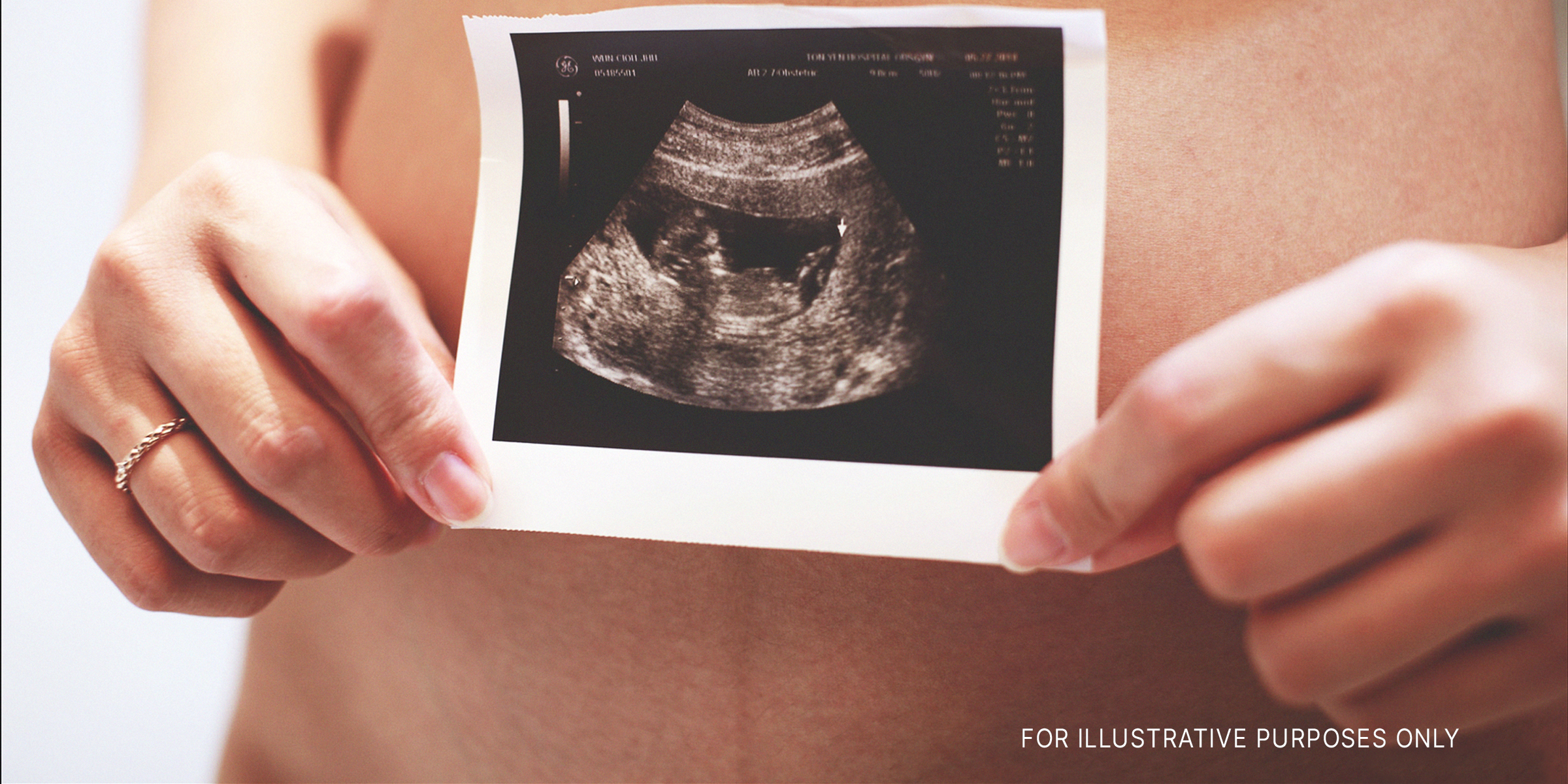 A woman holding an ultrasound scan | Source: Flickr.com