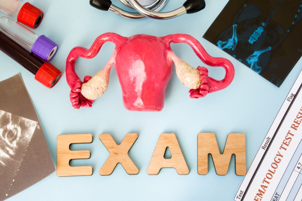 Modèle d’examen d’organes reproducteurs féminins entouré de tests de laboratoire, d’équipement médicaux et de résultats d’examens. | Shutterstock Modèle d’examen d’organes reproducteurs féminins entouré de tests de laboratoire, d’équipement médicaux et de résultats d’examens. | Shutterstock