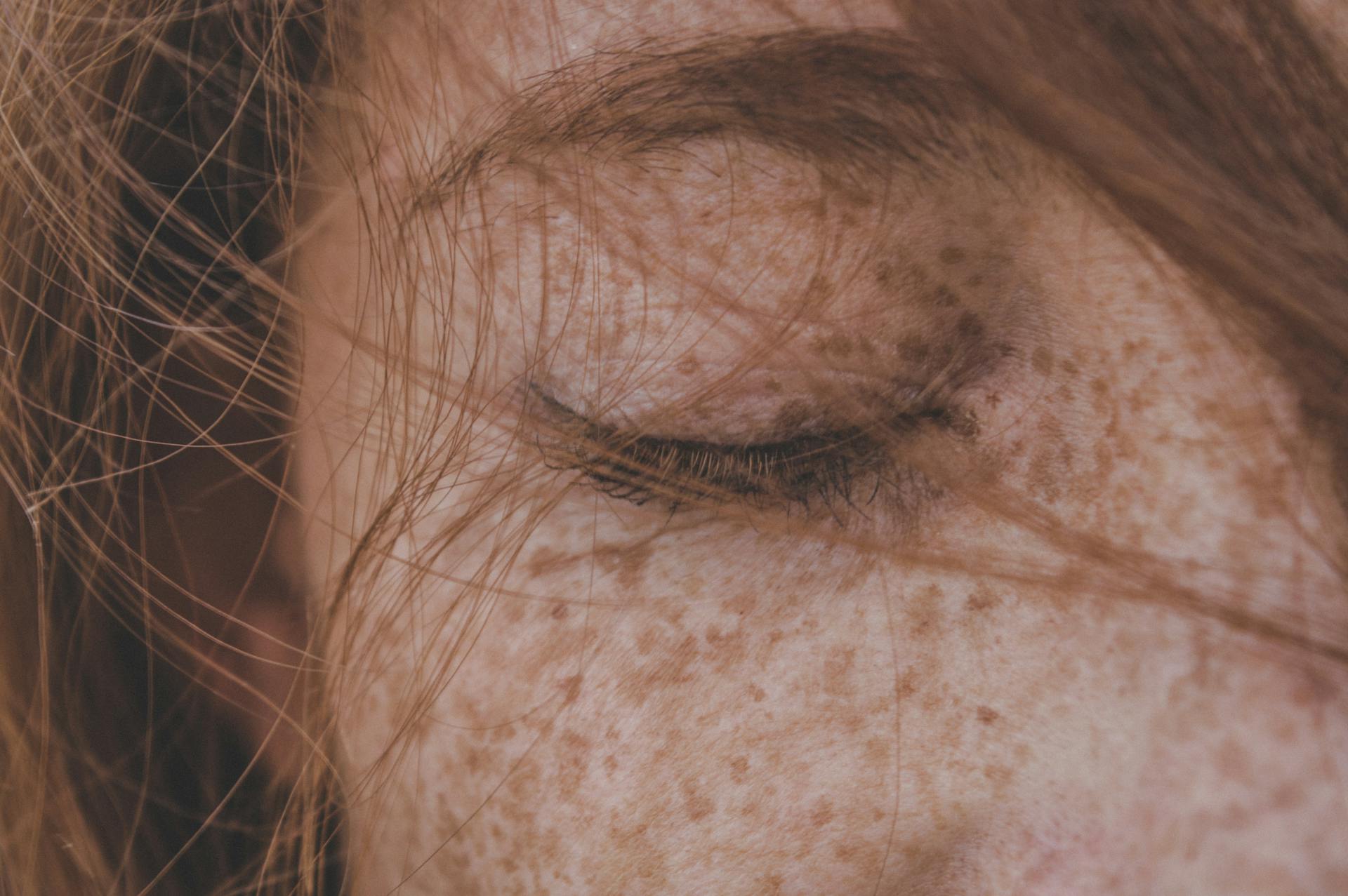 A close-up of a woman's freckles | Source: Pexels