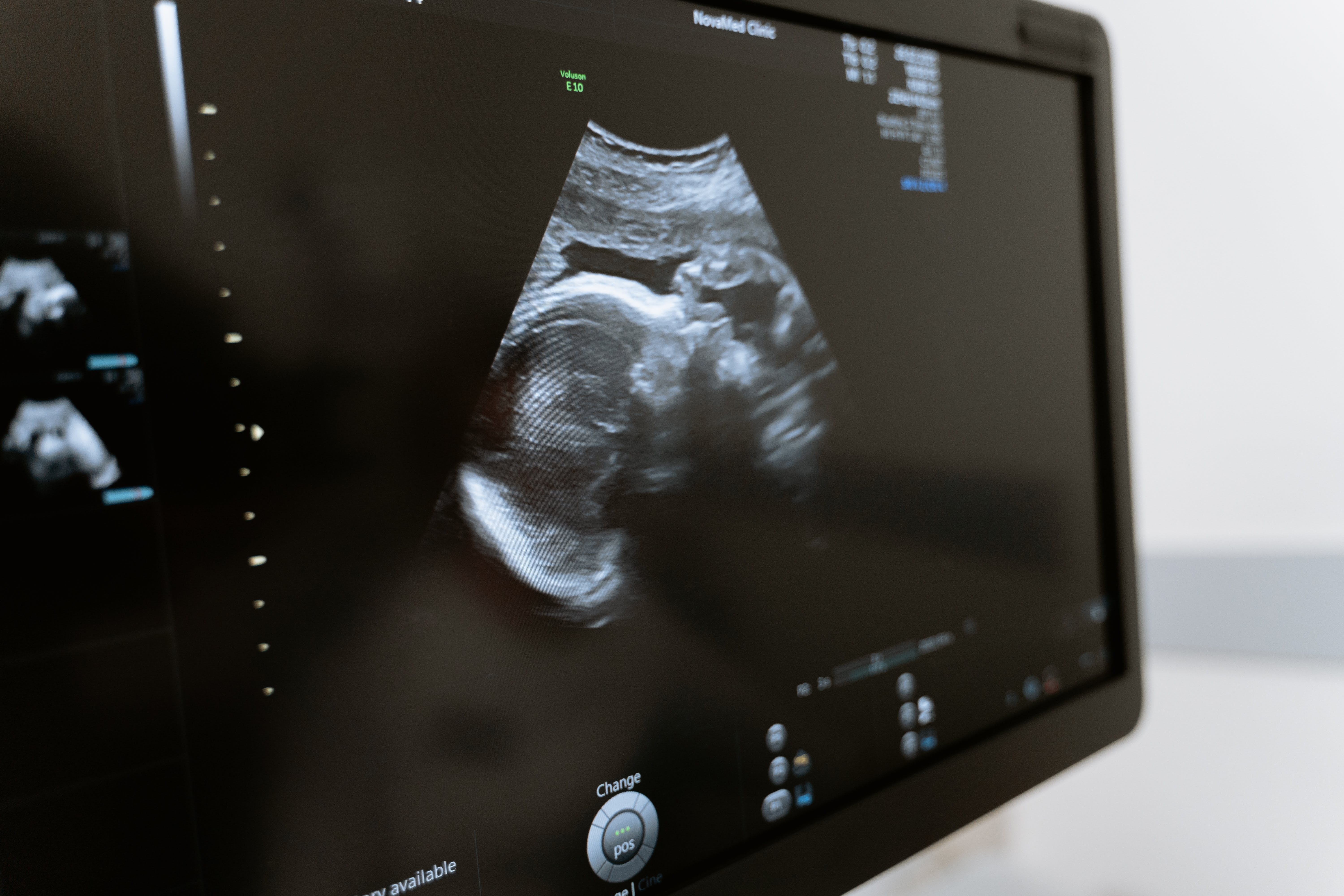 An ultrasound | Source: Pexels