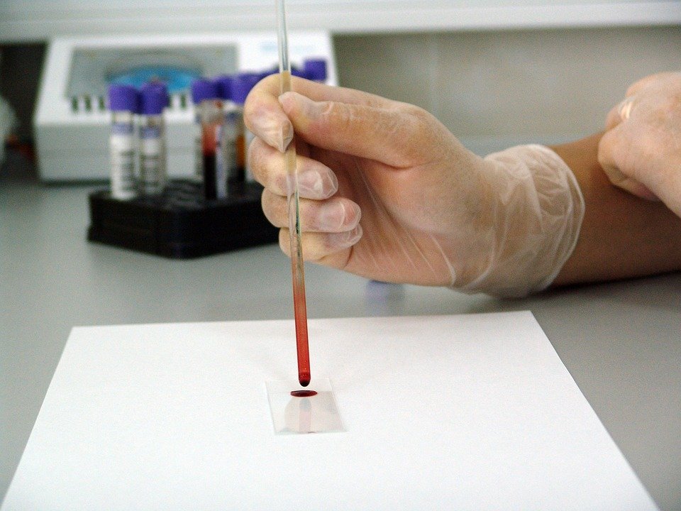 Especialista estudiando la sangre / Imagen tomada de: Pixabay Especialista estudiando la sangre / Imagen tomada de: Pixabay