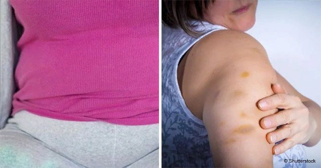 Many women ignore these 15 symptoms but they can be signs of cancer, according to doctors
