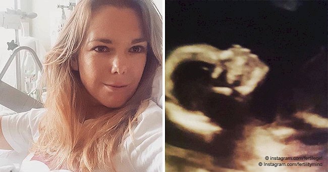 ‘Something wrong with the machine?’ Woman discovers she is sick 20 minutes into her ultrasound