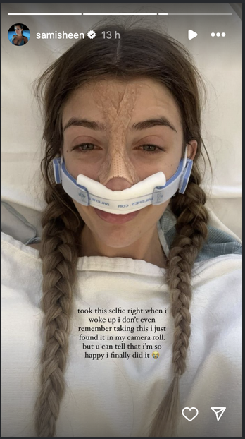 SSami Sheen shares her experience after undergoing a nose job, on her Instagram Stories on August 15, 2024 | Source: Tiktok/@samisheen