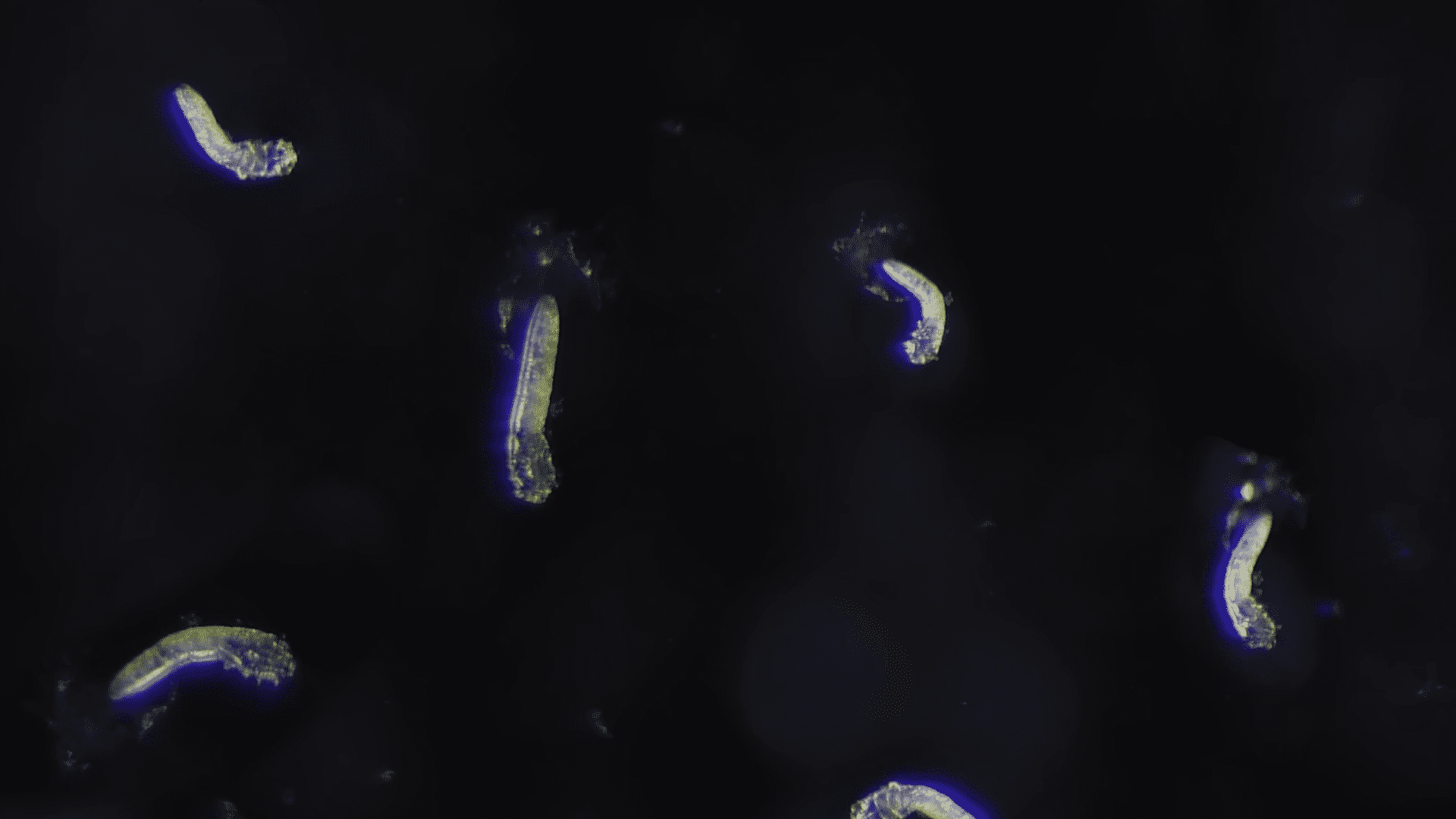 Ácaro facial bajo el microscopio │Imagen tomada de: YouTube / Deep Look Ácaro facial bajo el microscopio │Imagen tomada de: YouTube / Deep Look