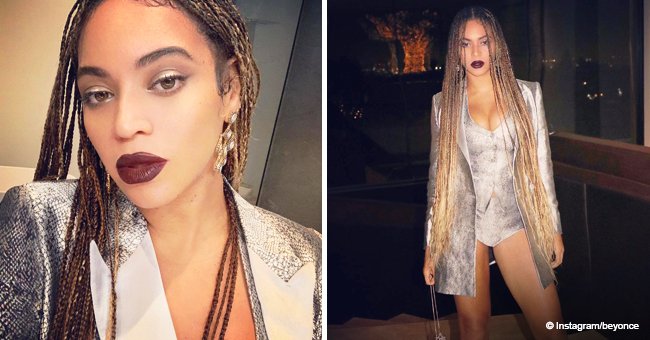 Beyonce gets slammed for bleaching her skin & trying to look like 'white girl' in new photos