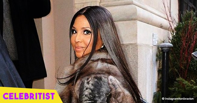 Toni Braxton shares new photo with father after plastic surgery rumors