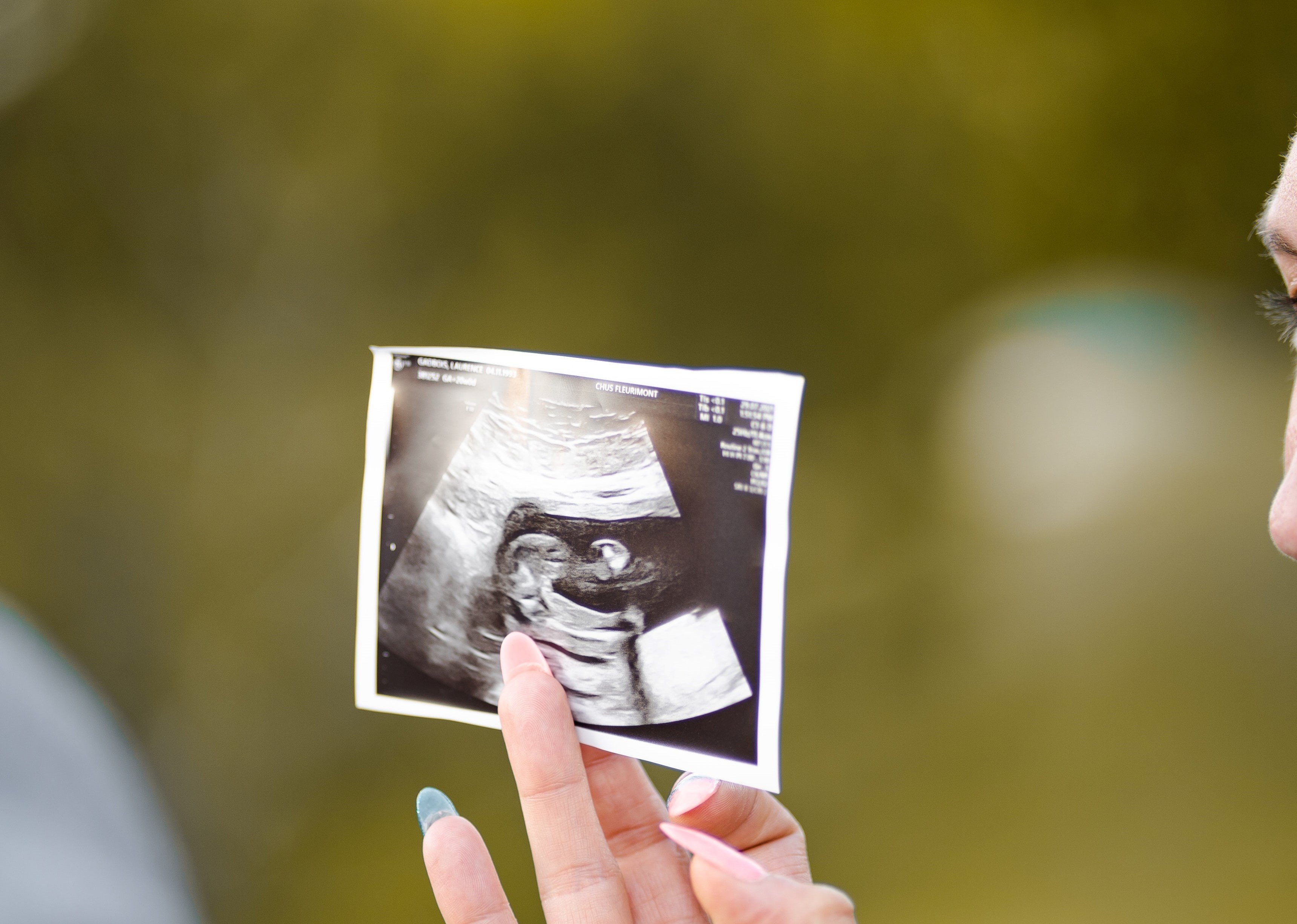 A woman holding an ultrasound picture | Source: Unsplash