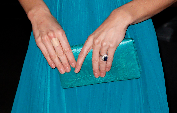 A close-up of Princess Catherine's hands at the Tusk Conservation Awards in London, England on November 8, 2018 | Source: Getty Images