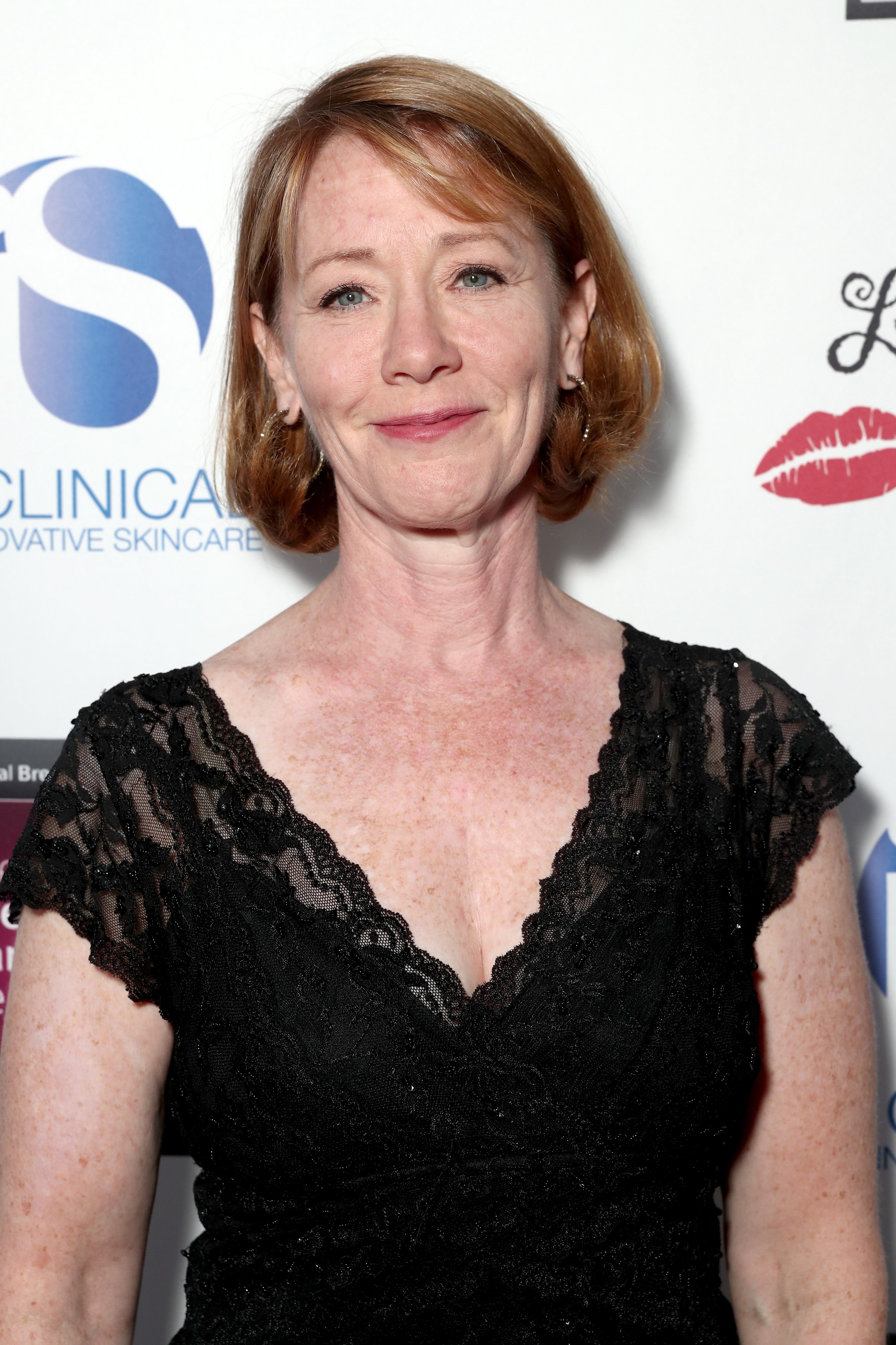  Ann Cusack at the National Breast Cancer Coalition Fund's 17th Annual Les Girls Cabaret in 2017 in Los Angeles, California. | Source: Getty Images