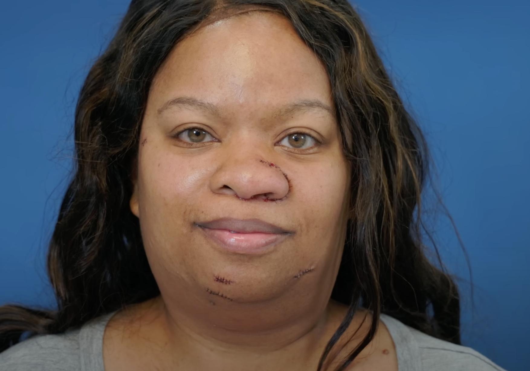 Danielle after surgery dated | Source: YouTube/@Dr.Truesdale