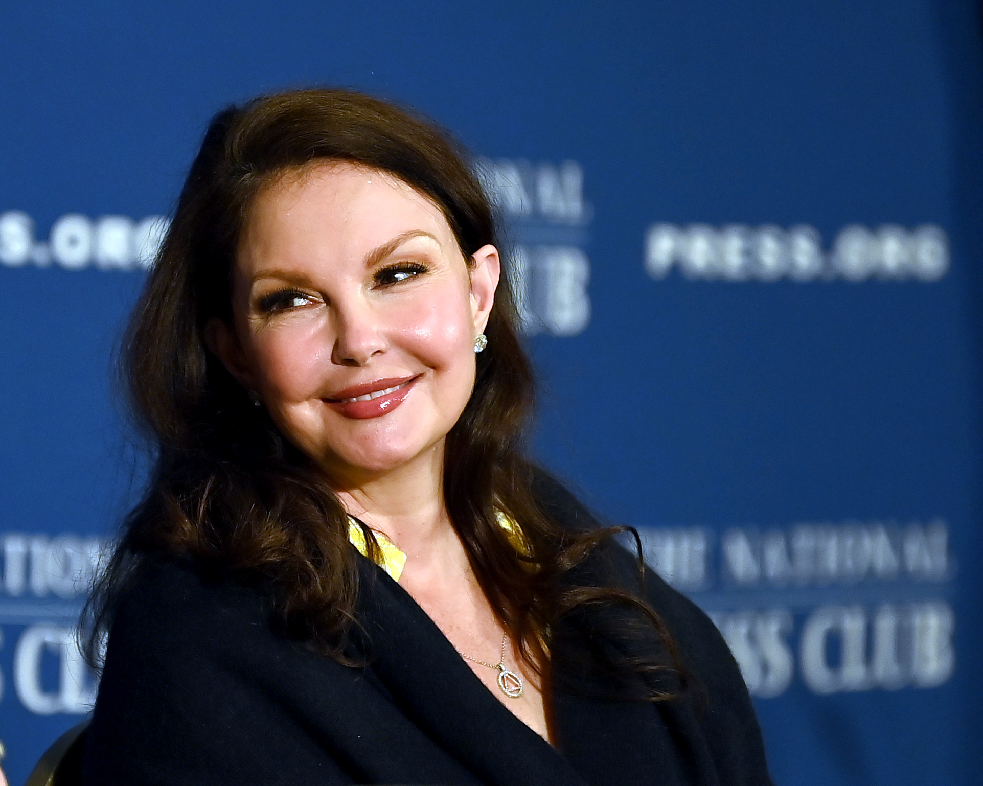 Ashley Judd's Face Changed Due to Migraine Treatments - The Actress ...