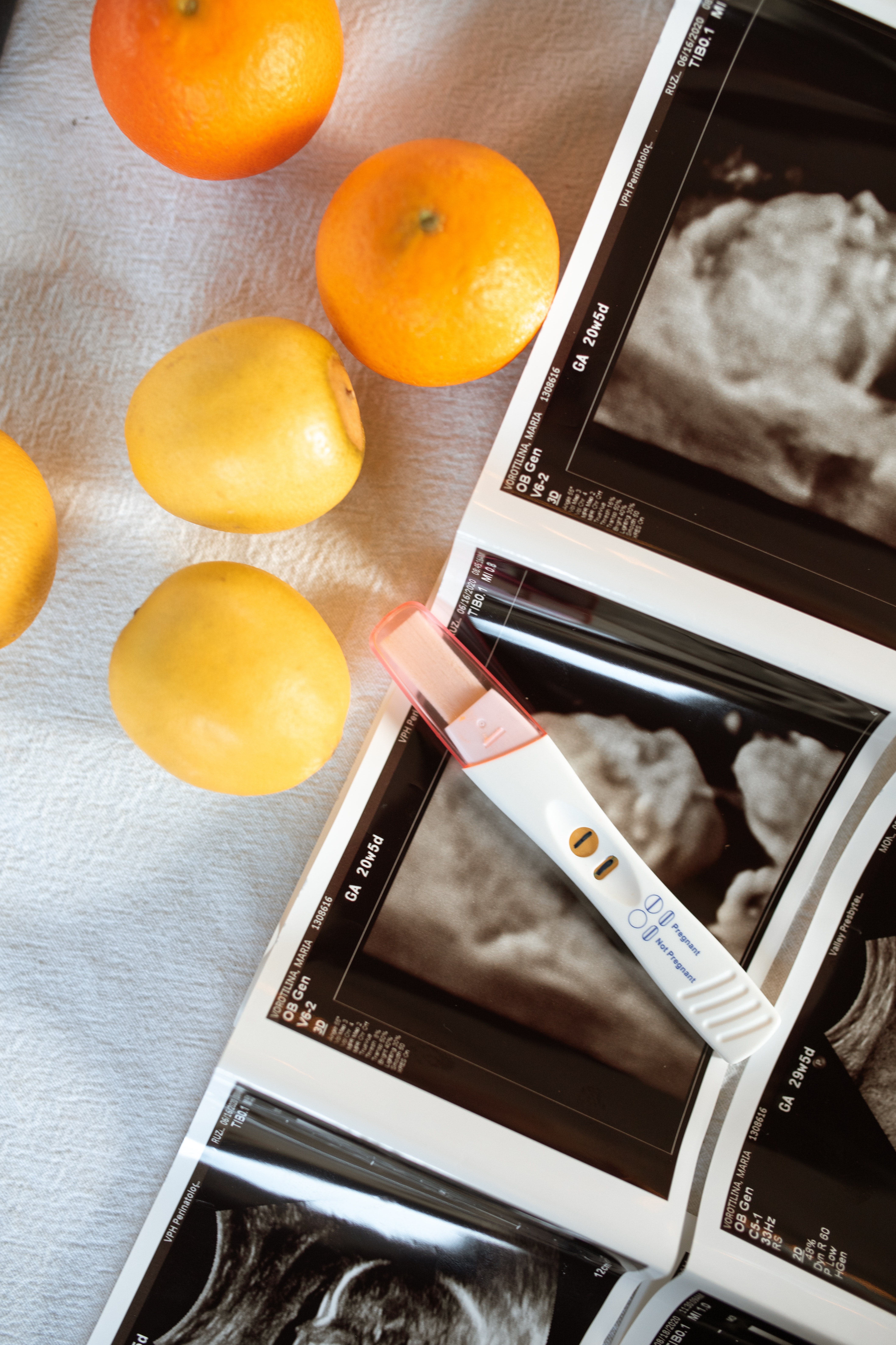 Ultrasound image and pregnancy test kit | Source: Pexels