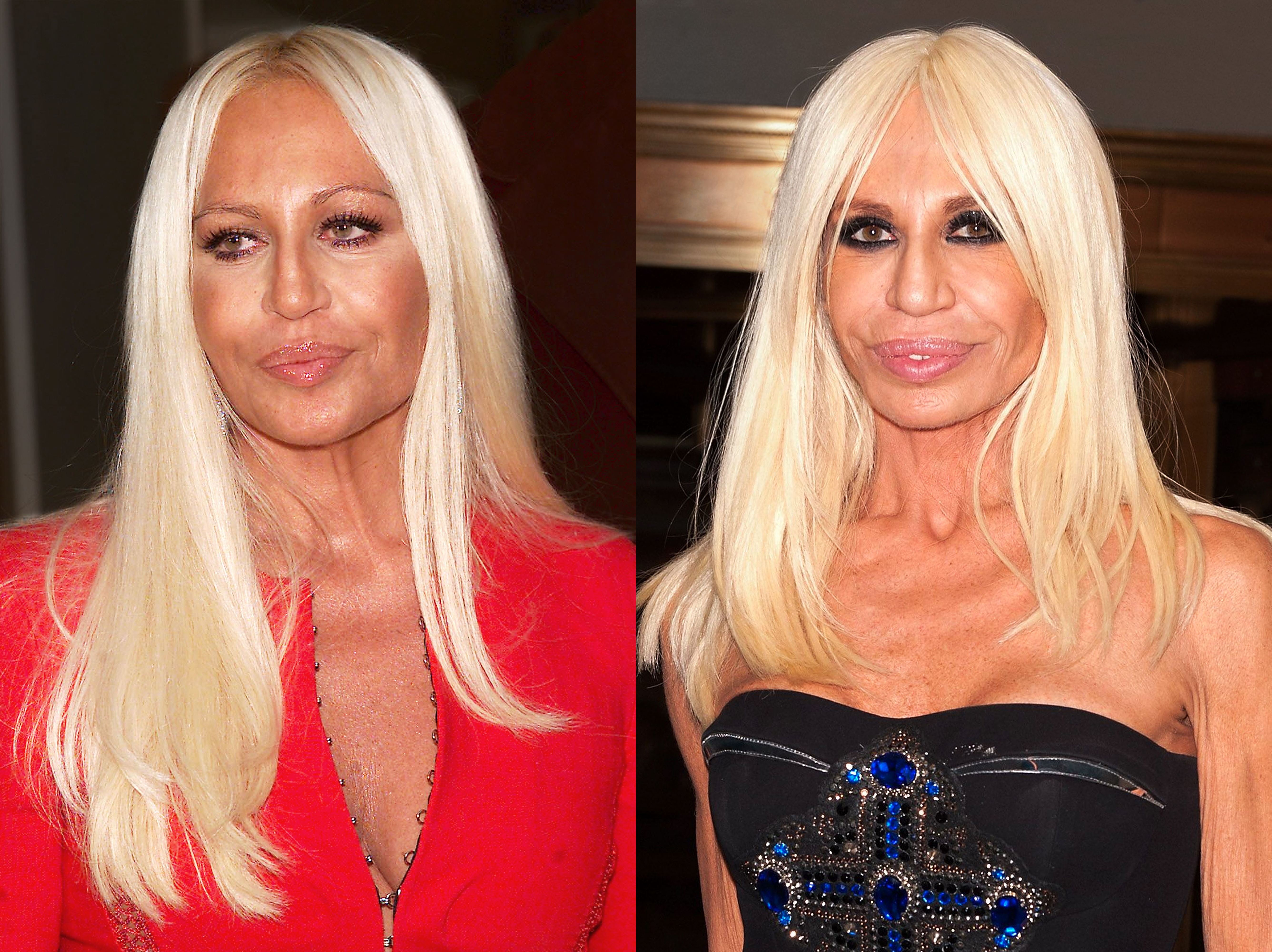 Donatella Versace in 2001 vs 2012 | Source: Getty Images