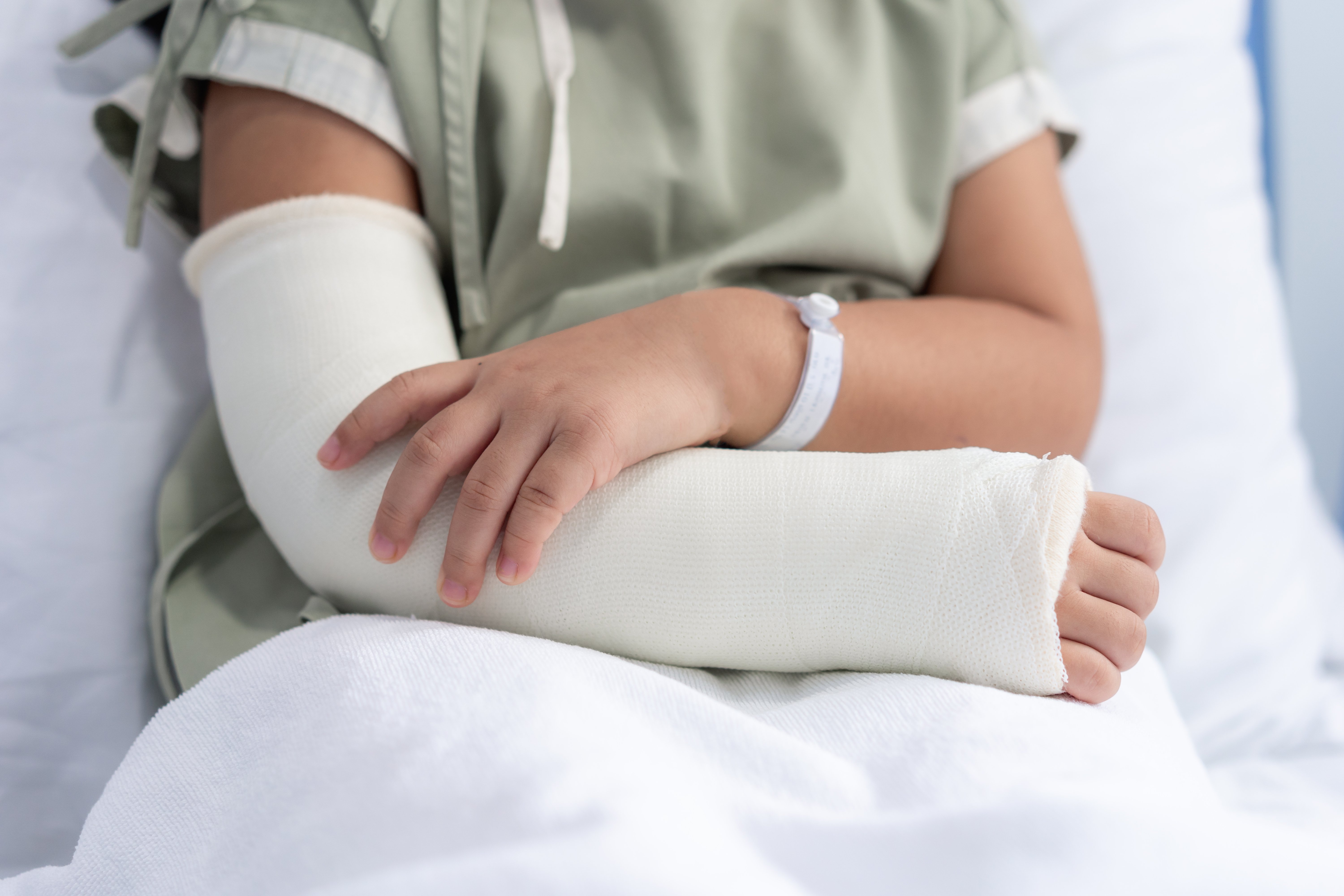 Mujer en cama de hospital con brazo enyesado. | Foto: Shutterstock