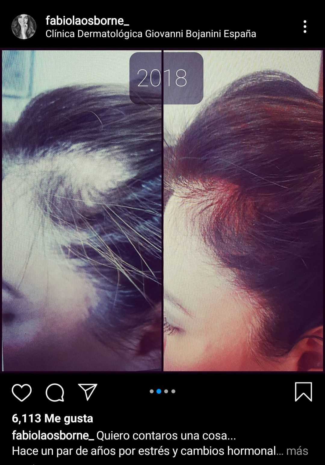 Captura de la secuencia de fotos del antes y el después de Fabiola Martínez. | Foto: Instagram/fabiolaosborne_/