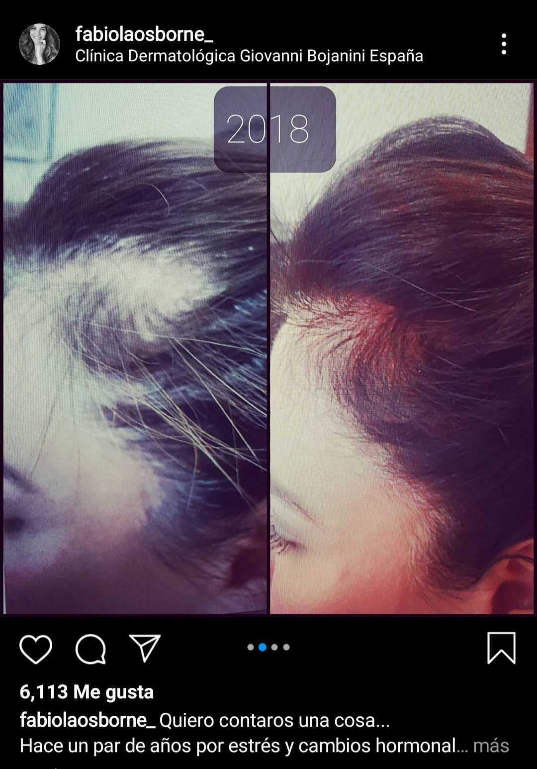 Captura de la secuencia de fotos del antes y el después de Fabiola Martínez. | Foto: Instagram/fabiolaosborne_/ Captura de la secuencia de fotos del antes y el después de Fabiola Martínez. | Foto: Instagram/fabiolaosborne_/