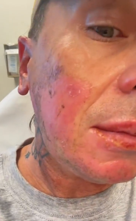 Screenshot of Sid Wilson's face after an explosion | Source: Instagram/sidthe3rd