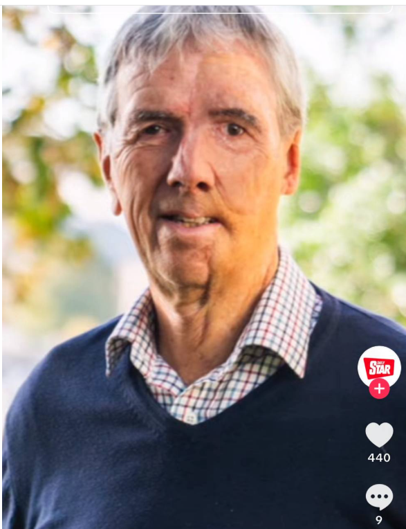 Dave Richards with his prosthetic face | Source: TikTok/TheDailyStar