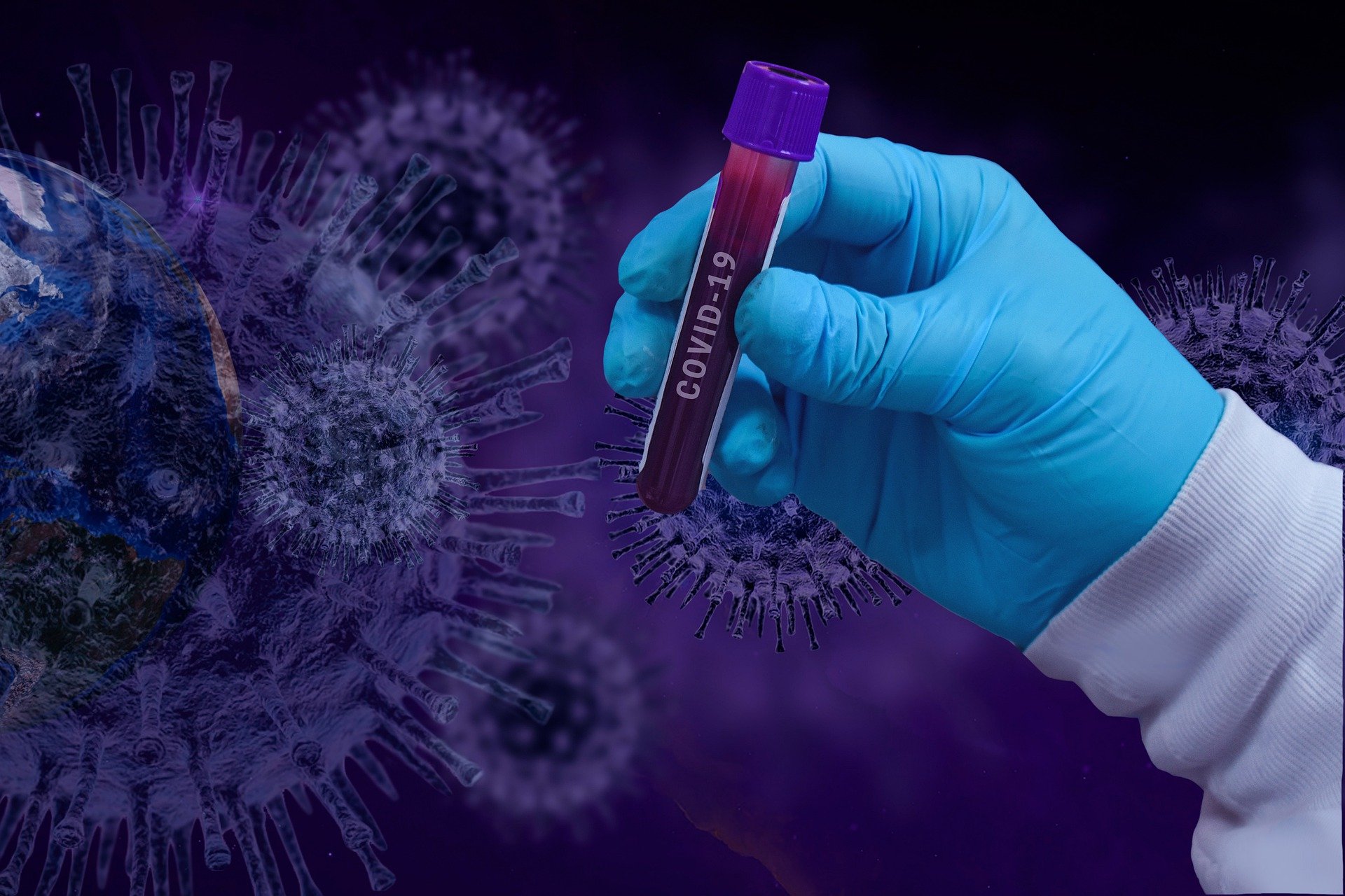 Medizinisches Personal hält eine Blutphiole mit der Aufschrift COVID-19 | Quelle: Pixabay