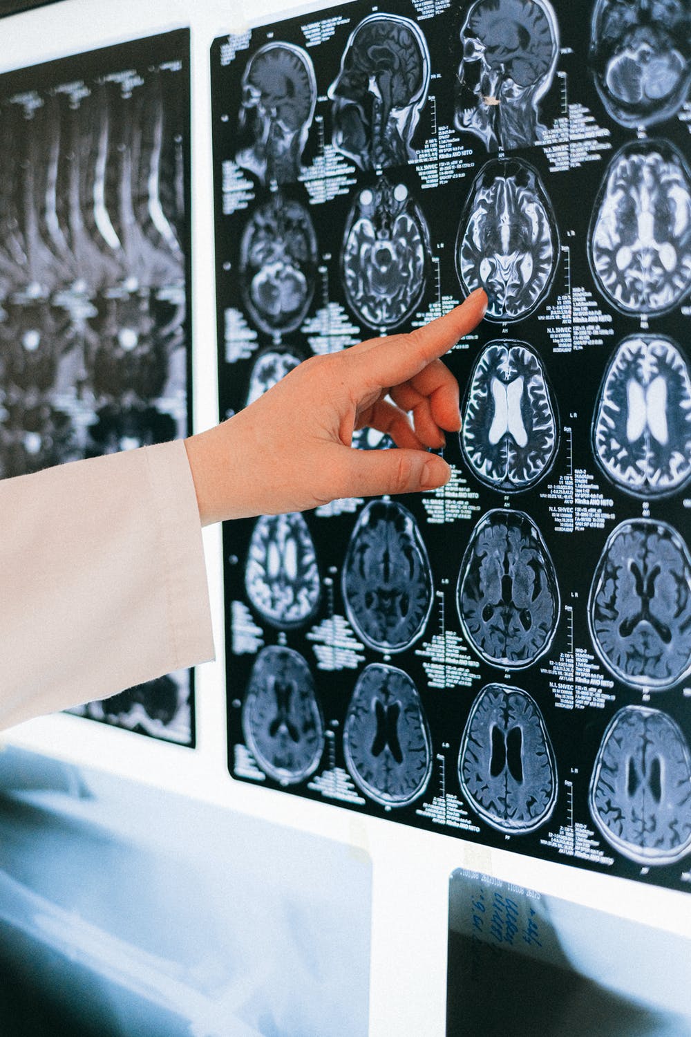 The doctor explained to Jessica that her husband had a brain tumor | Source: Pexels