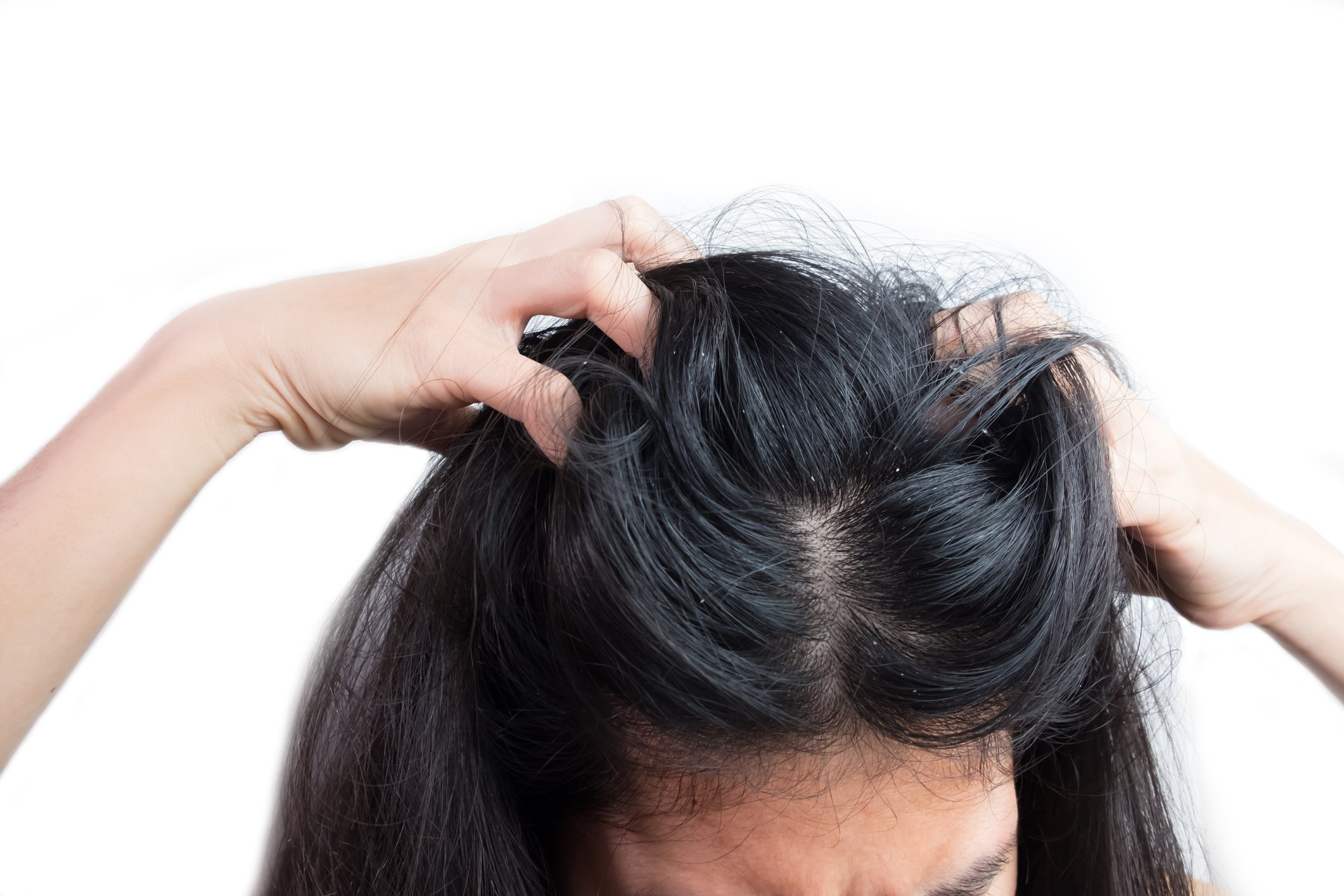 Une femme qui se gratte les cheveux. | Photo : Getty Images