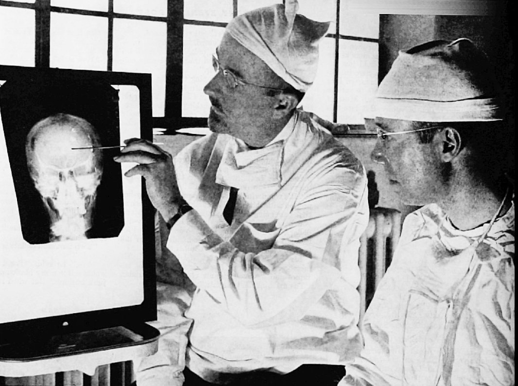 Dr. Walter Freeman and Dr. James W Watts, the doctors who performed Rosemary's lobotomy. | Source: Wikimedia Commons