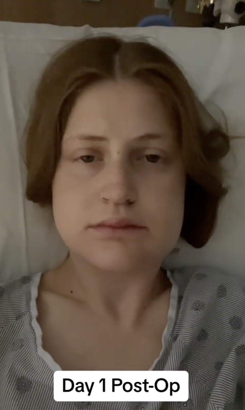 Still in hospital, Virginia Elder faces the camera with a swollen, expressionless look on Day 1 after surgery. | Source: TikTok/virginiaeelder