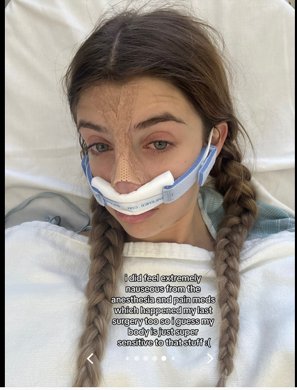 Sami Sheen shares her experience getting a nose job done, on a TikTok post dated August 13, 2024 | Source: Tiktok/@samisheen