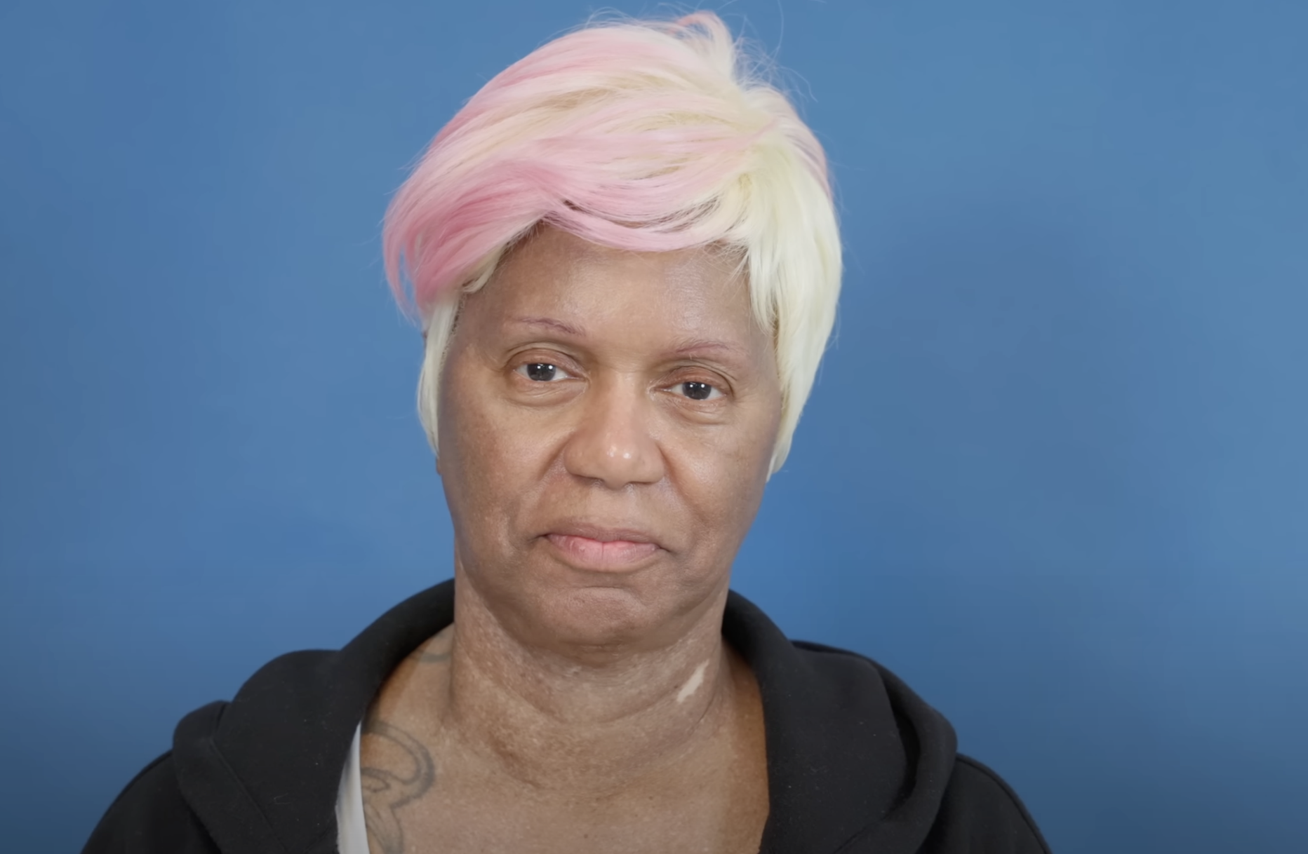 Diana before surgery, dated August 23, 2024 | Source: YouTube/@Dr.Truesdale