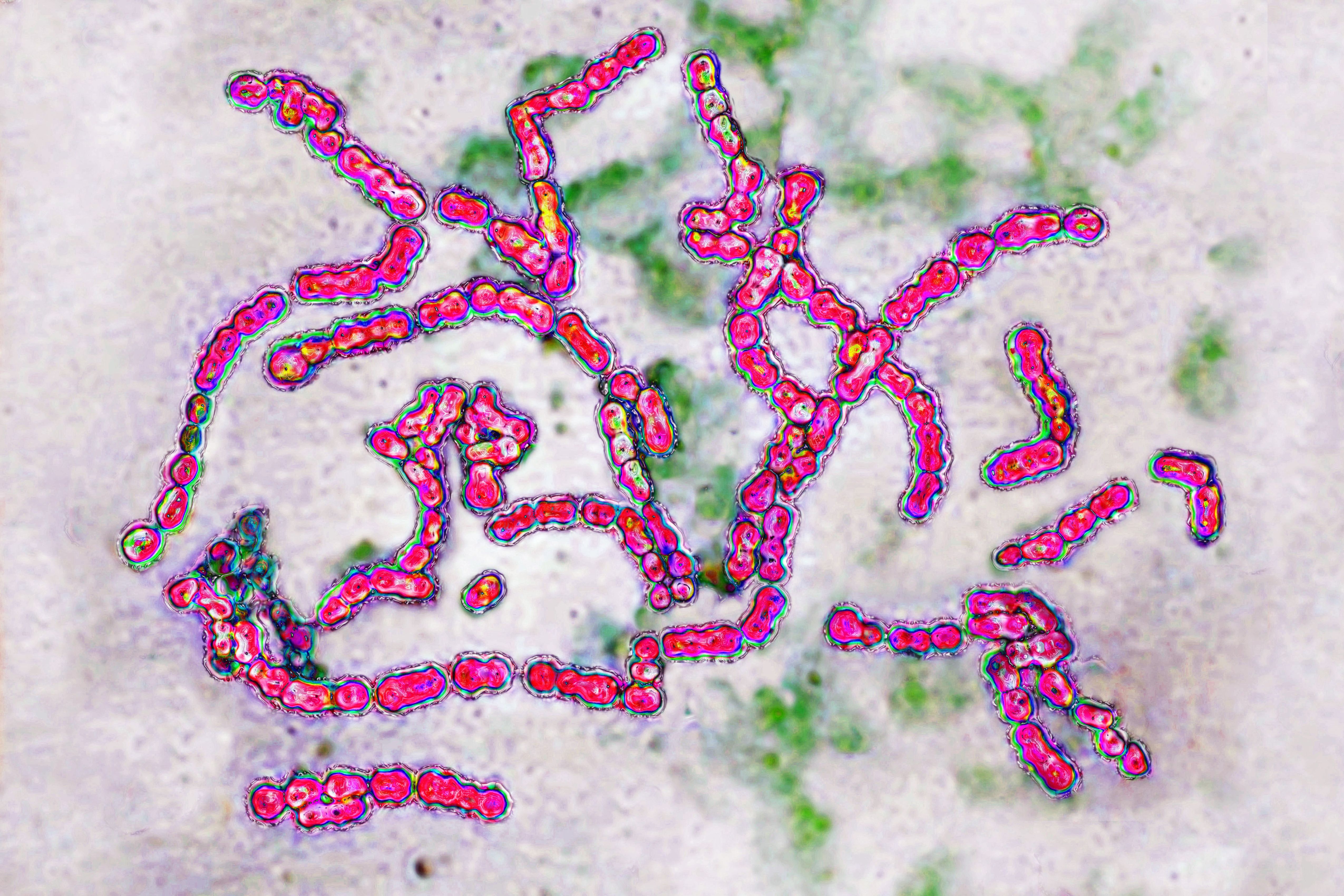 Group A Streptococcus pyogenes, the bacterium linked to strep throat and other infections | Source: Getty Images