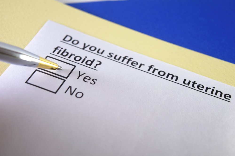 ¿Sufre de fibromas uterinos? Sí o no. Fuente: Shutterstock ¿Sufre de fibromas uterinos? Sí o no. Fuente: Shutterstock