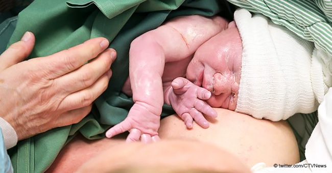 Das ist das erste Baby, das aus Gebärmuttertransplantation durch Roboter geboren wurde
