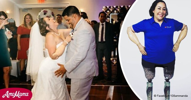 Woman without arms or legs beats all odds to dance at her own wedding